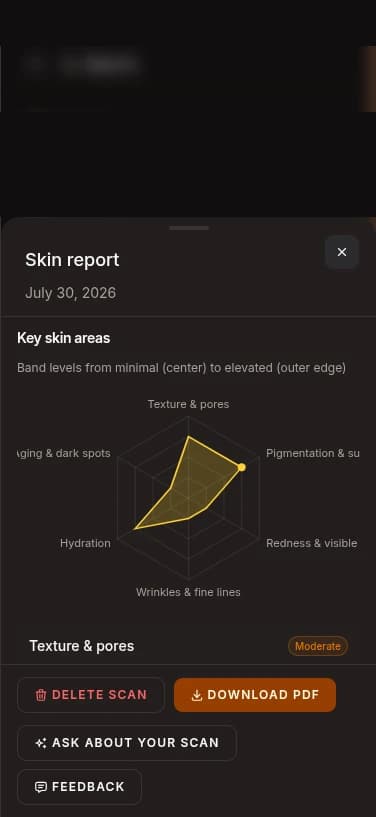 Aura skin report on a phone, showing band levels across six key skin areas